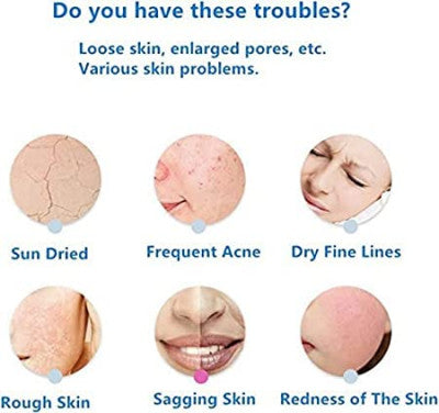 SILICONE ICE ROLLER (PACK OF 3)